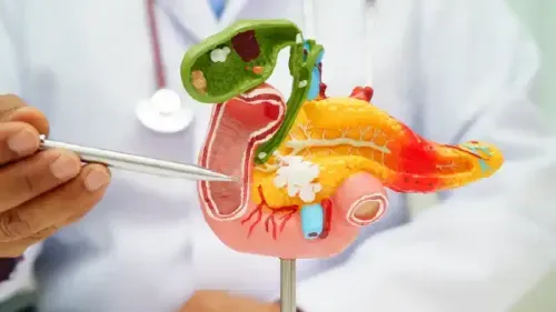 How to Prevent Pancreatitis - Lifestyle Tips for a Healthy Pancreas